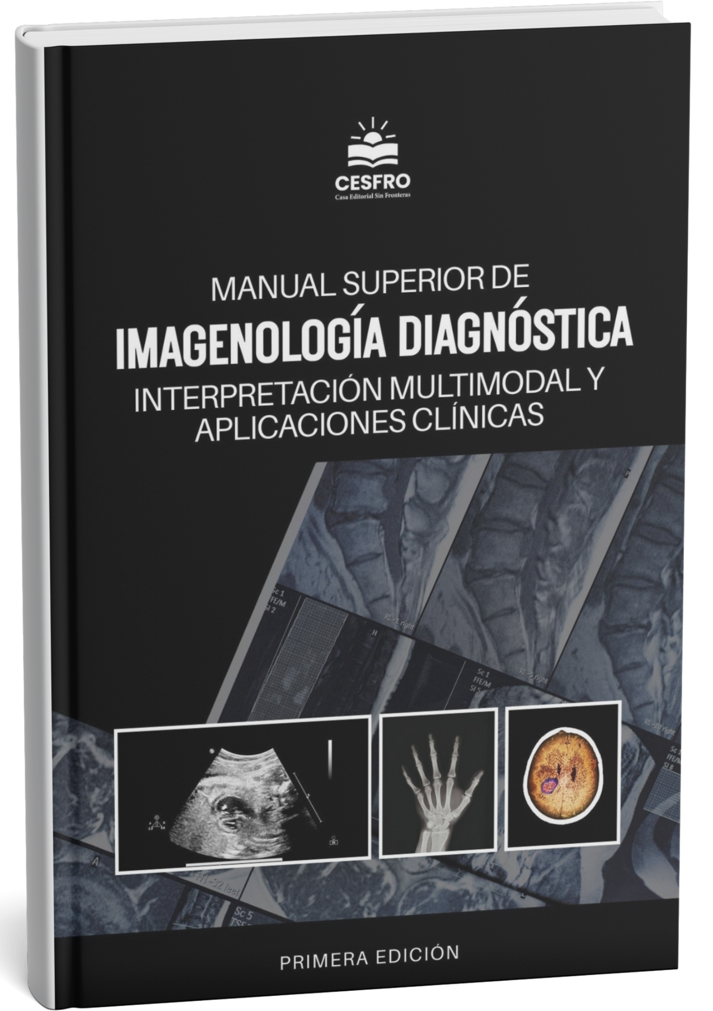 Manual Superior de Imagenología Diagnóstica Interpretación multimodal y aplicaciones clínicas